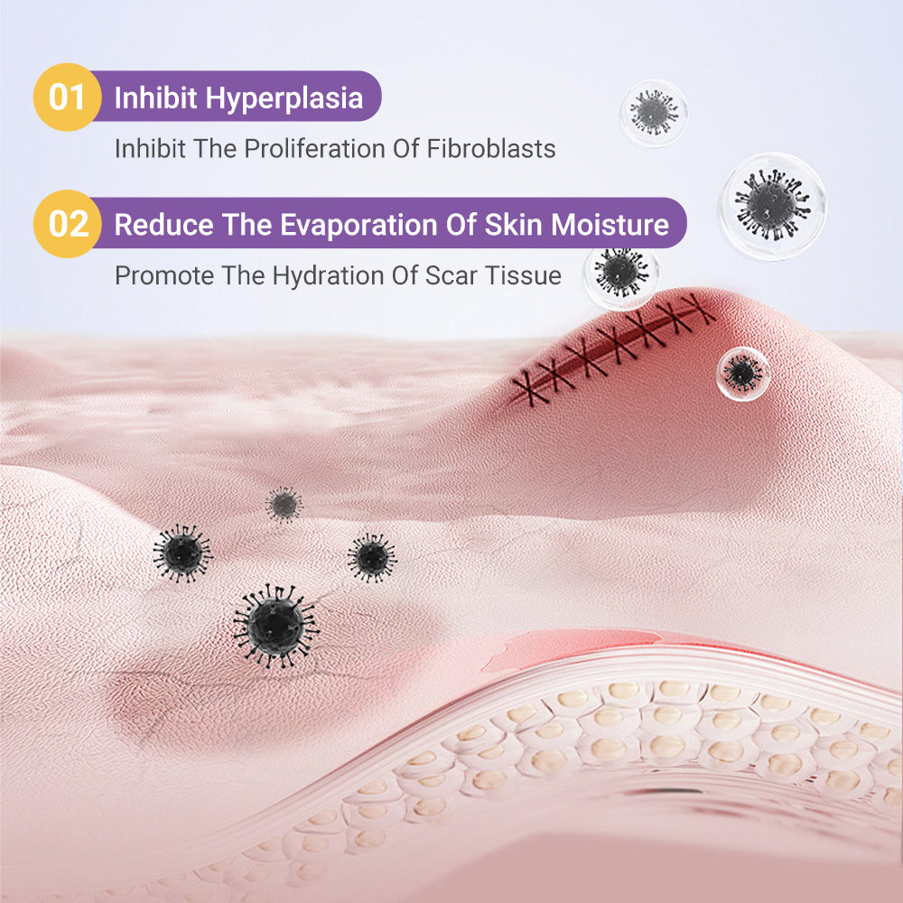 ✅Official Store |ODEIUN™ Hyaluronic Acid Nano Microneedle Repair Tape🏥(Treatment of old and new scars, reduction of surgical scars, stretch marks, keloids, acne, burns, warts, dermatomes and varicose veins)