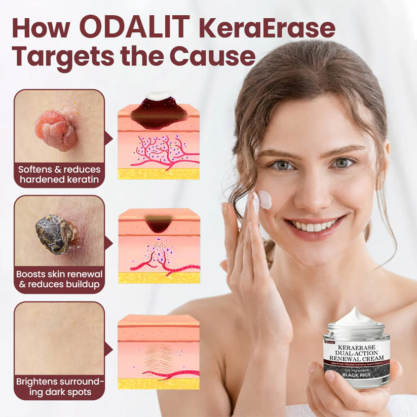 ODEIUN™KeraErase Dual-Action Renewal Cream