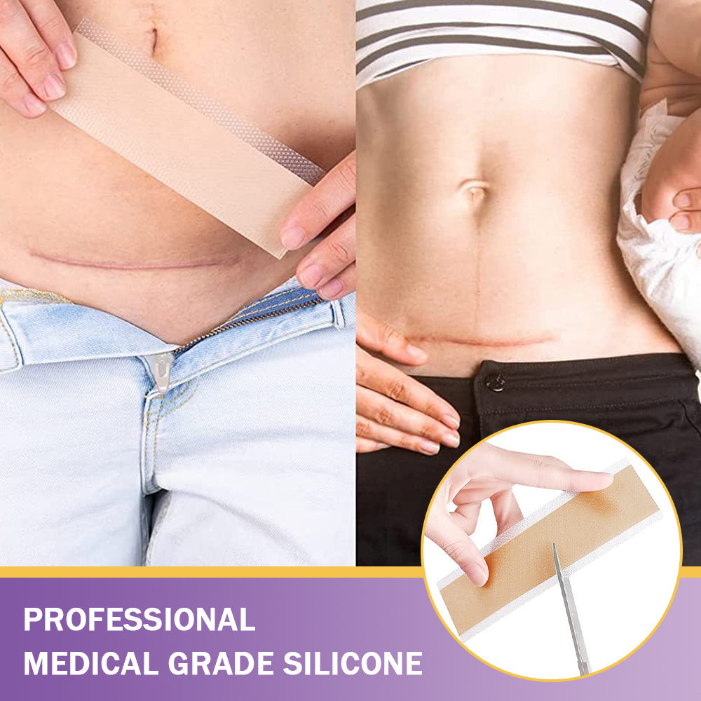 ✅Official Store |ODEIUN™ Hyaluronic Acid Nano Microneedle Repair Tape🏥(Treatment of old and new scars, reduction of surgical scars, stretch marks, keloids, acne, burns, warts, dermatomes and varicose veins)